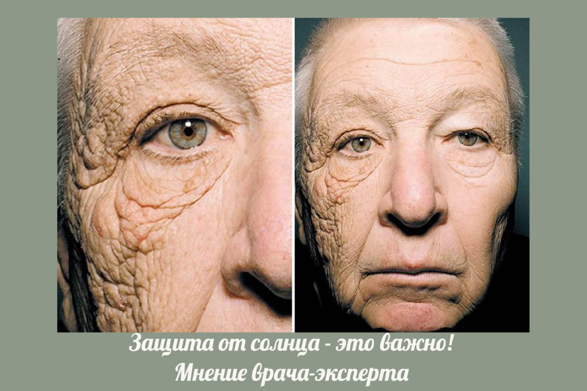 Защита от солнца. Зачем нужен SPF, как загорать правильно. 