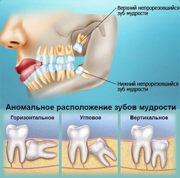 Зуб восьмерка картинка рисунок