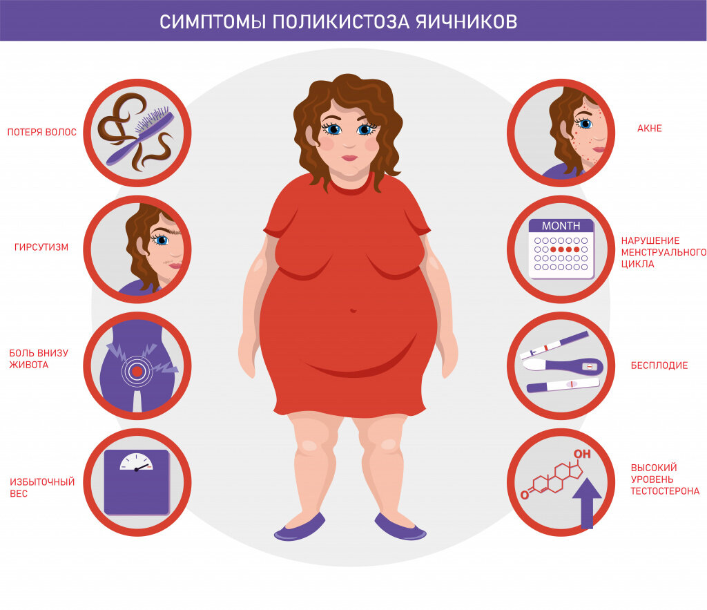 Источник фото: яндекс