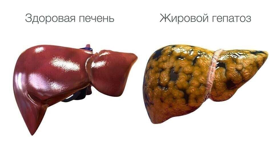 Взято с Яндекс картинок