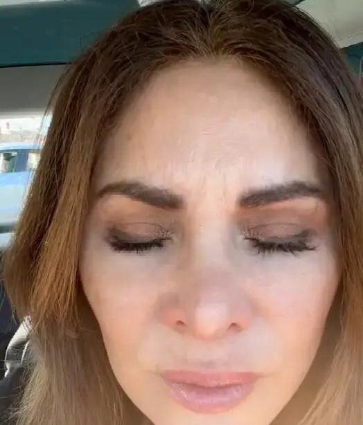 Ботоксное лицо как выглядит Plastik cerrahi, Lisa rinna