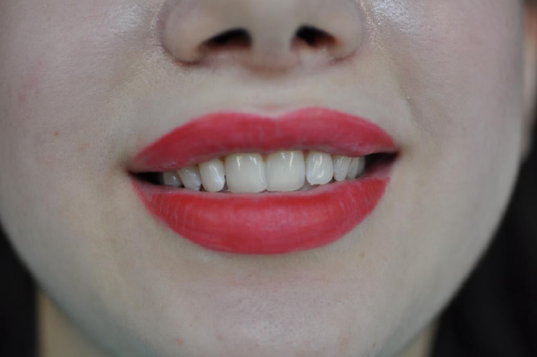 Стоковые фотографии по запросу Улыбка красивые зубы