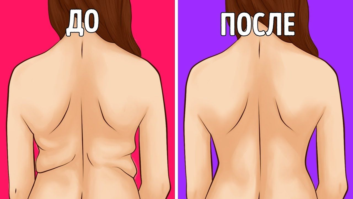 3 главных врага "бесящих ушек" на животике, от которых они исчезнут  уже на 6-ой день