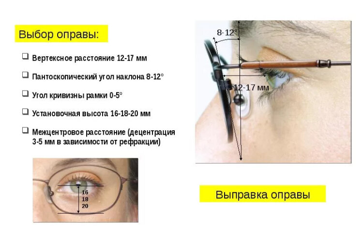 Выбор оправы 