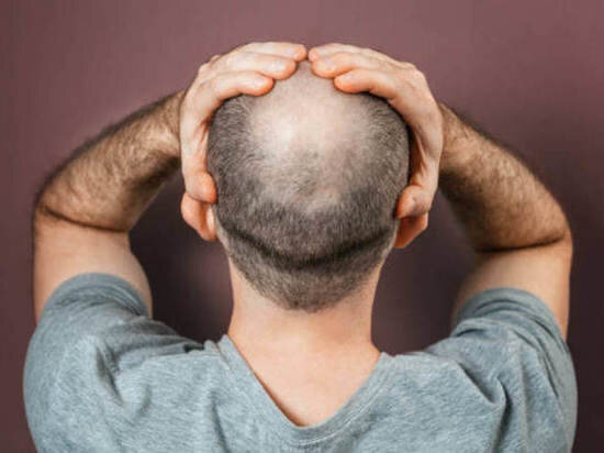     Многие мужчины сталкиваются с проблемой выпадения волос. Фото: pixabay.com