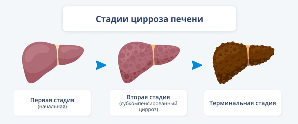 Можно ли делать МРТ печени?