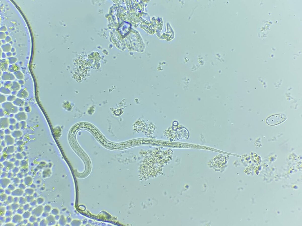 Угрица кишечная, увеличение 400Х