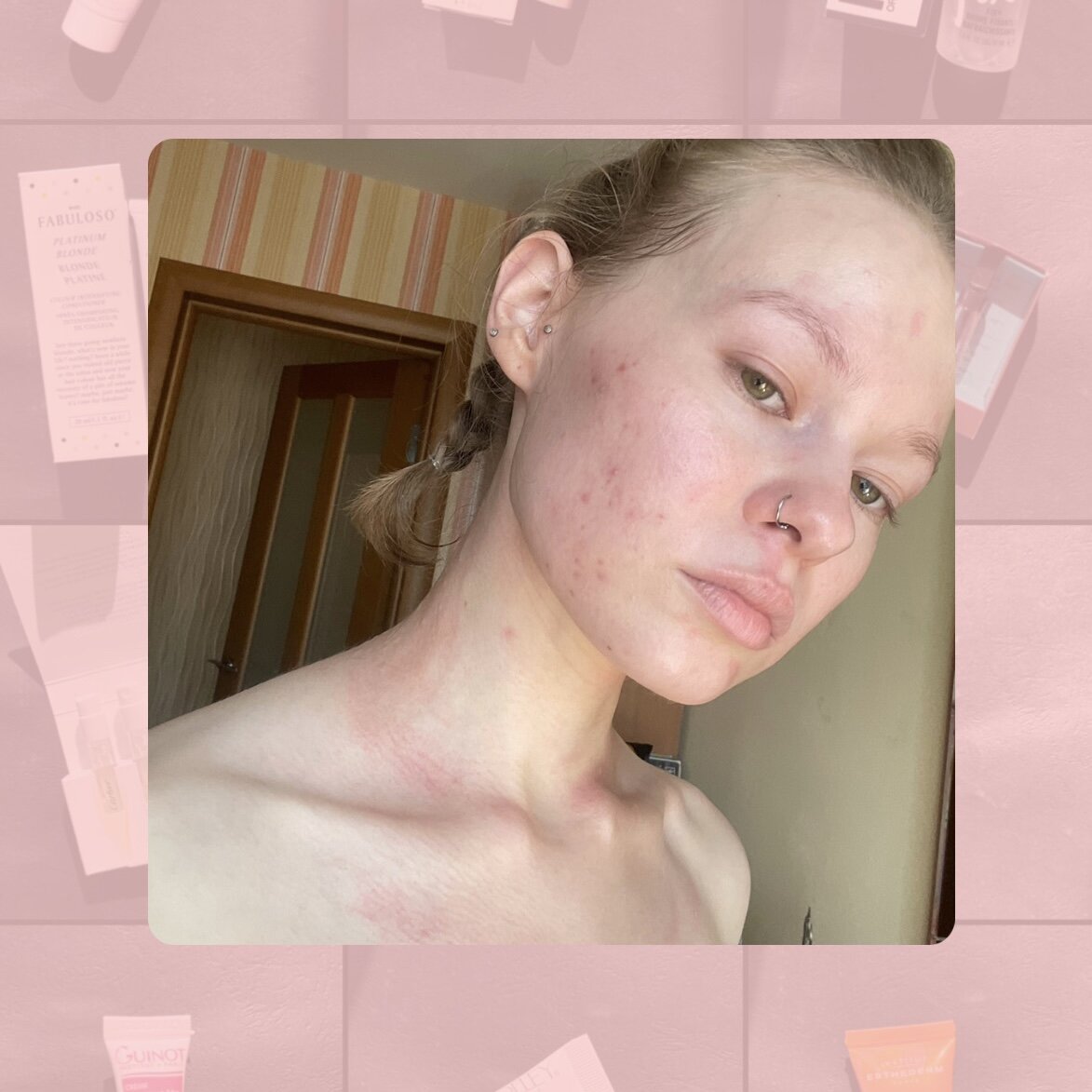 По долгу бьютиблогерской службы я довольно часто сталкиваюсь с аллергией на косметику