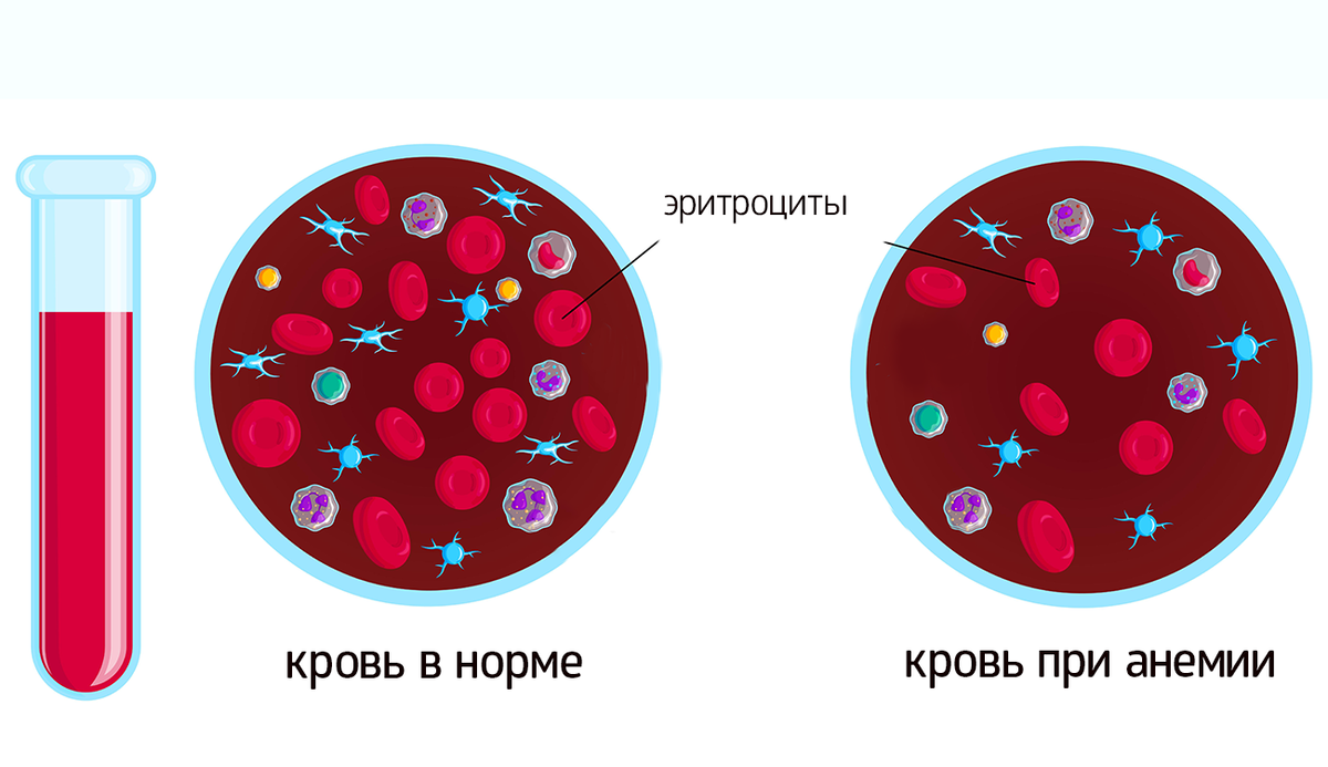 Признаки нехватки кислорода и 10 способов его добыть | Здоровье с B.Well |  Дзен