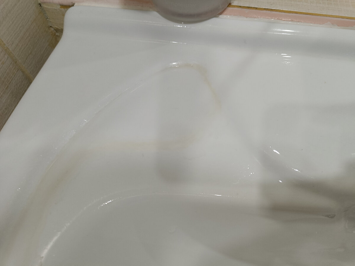 Жёлтые пятна мало какими средствами выводятся