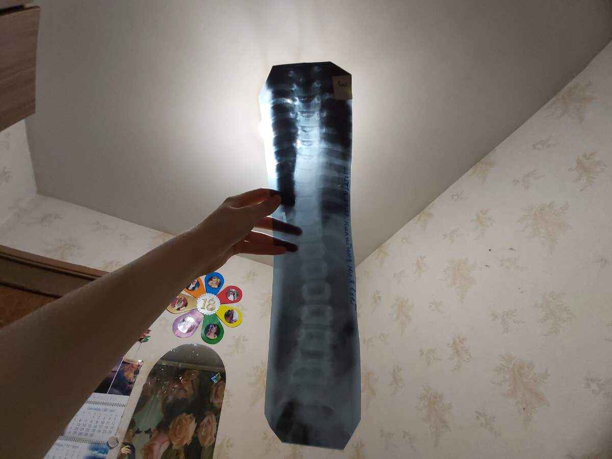 -2-2