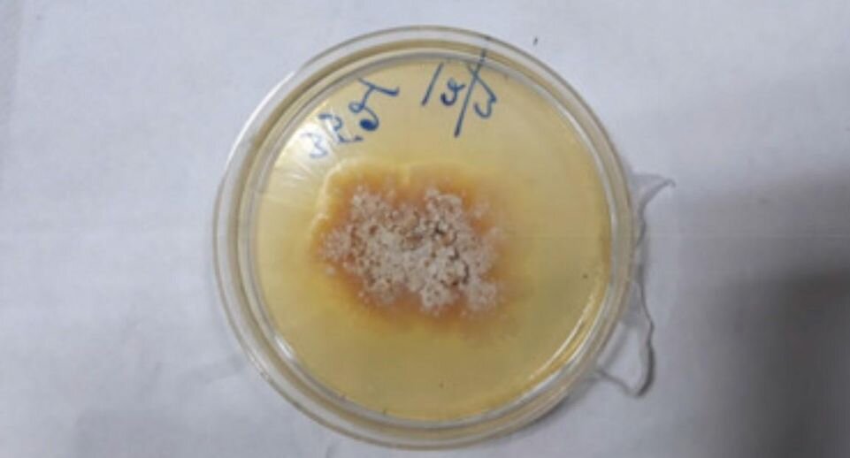 Medical Mycology Case Reports📷
