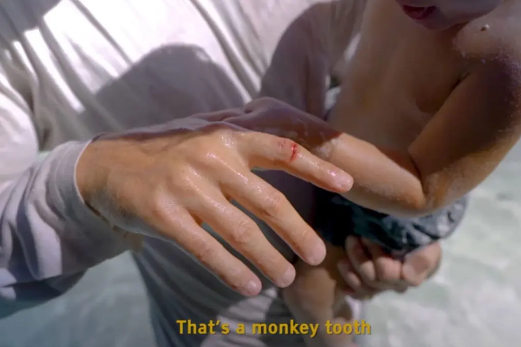    Если вас укусило уличное животное - обязательно отправляйтесь в клинику!YouTube