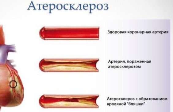 Фрагмент рисунка с сайта ГК Эксперт