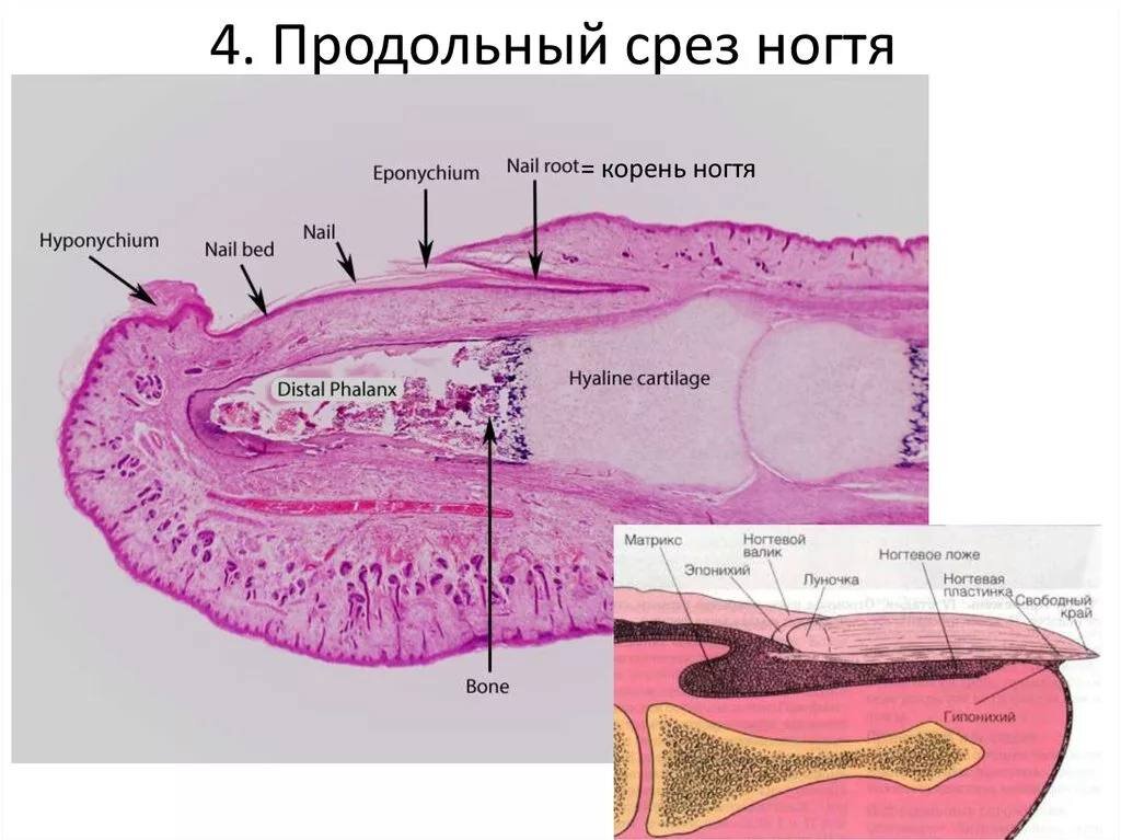 Гематома под ногтем