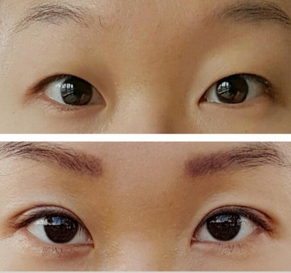 Двойное веко. Что значит второе веко. Сангапури "eye charm". Наклейки для нависшего века. Двойное веко на глазах.