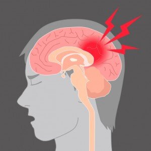 Как врачи определяют сотрясение мозга?