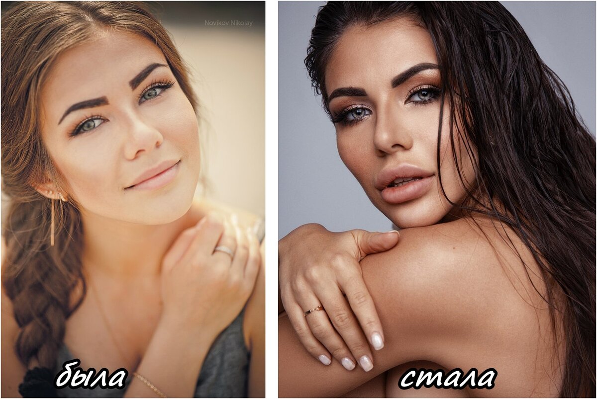 Стужук софия до и после пластики фото
