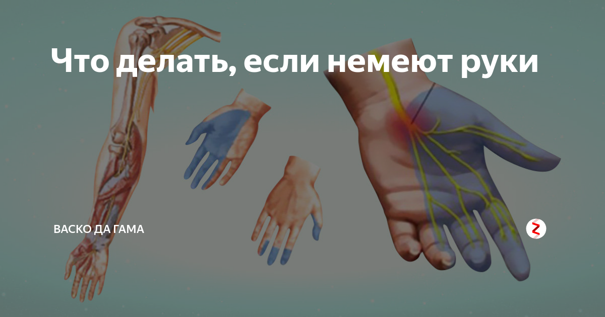 Немеет и болит. Онемение кисти правой руки. Кисть руки немеет и покалывает что это