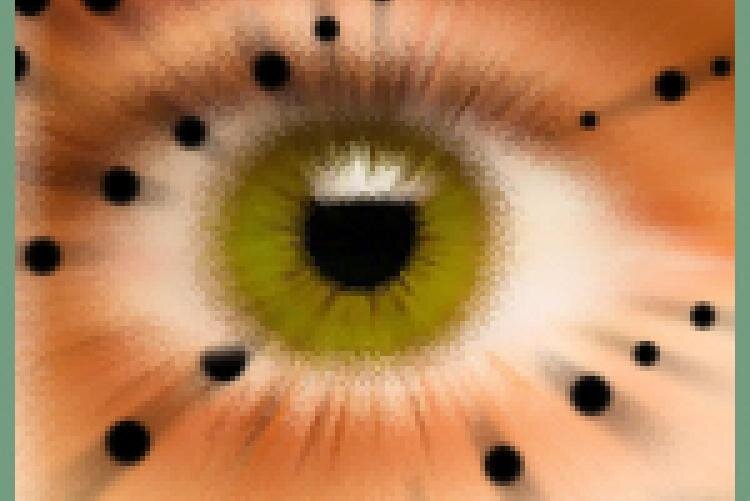 Черные точки в глазах – причины и лечение