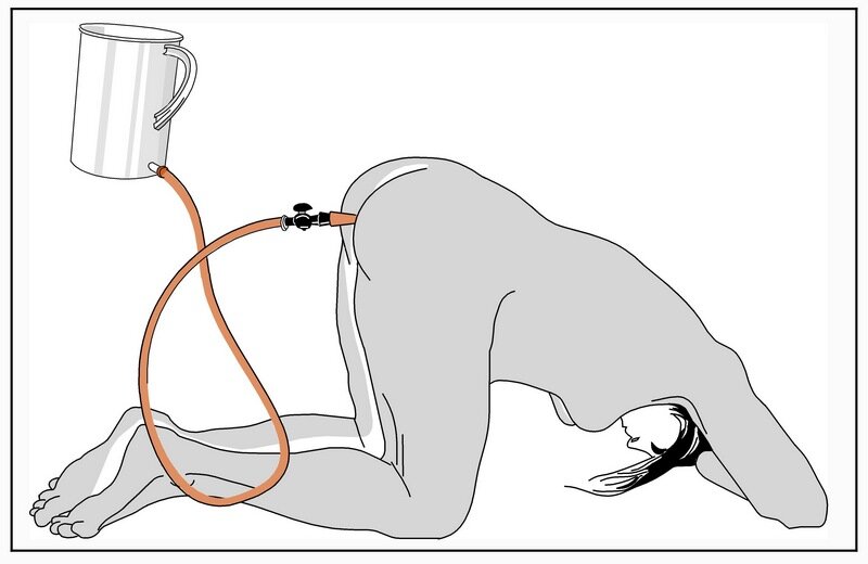 Трубка в прямую кишку. Промывание кишечника Кружка Эсмарха. Груша Эсмарха клизма. Правильная поза для клизмы. Как ставится очистительная клизма?.