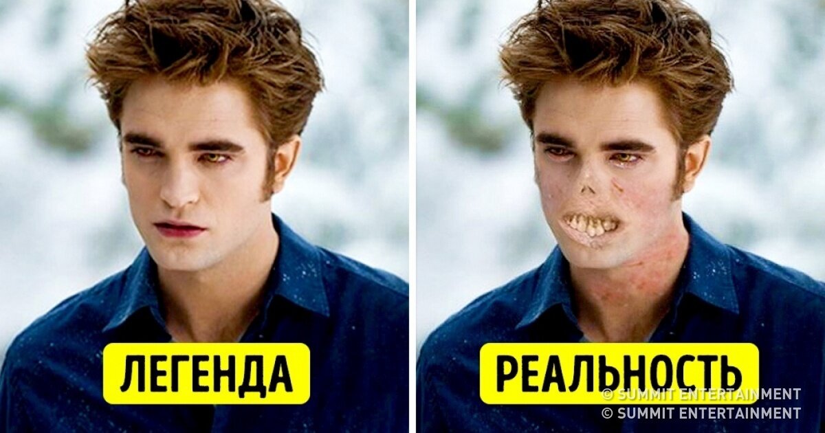 Эдвард Каллен (вампир из к/ф"Сумерки"). Реальность- так выглядят больные Порфирией.