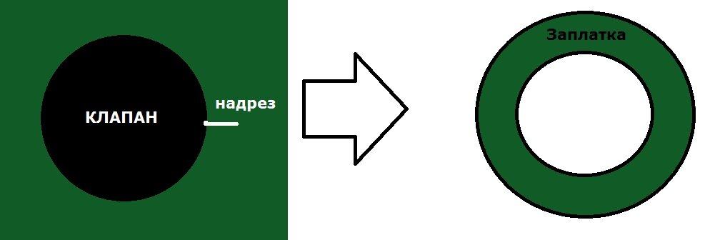 Делаем надрез, затем достаем клапан, затем вставляем основание нового клапана и ставим специальную заплатку, которая будет удерживать надрез.