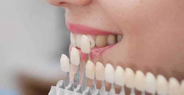  Полезные статьи