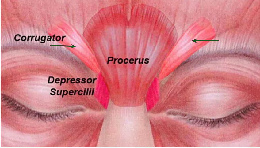 Corrugator supercilii