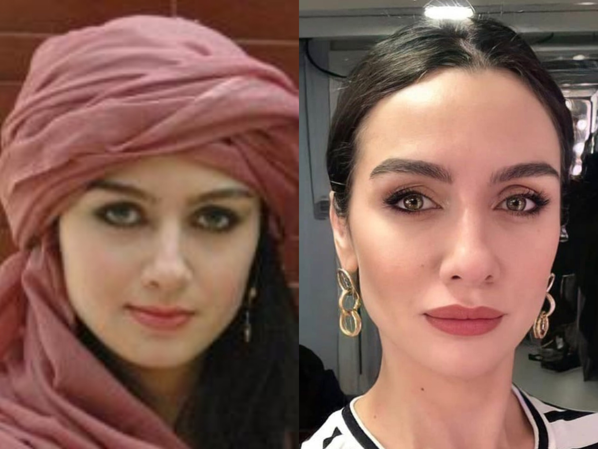 Догадаться нереально: 7 популярных турецких актрис, сделавших пластику. Сравниваем фото до и после!