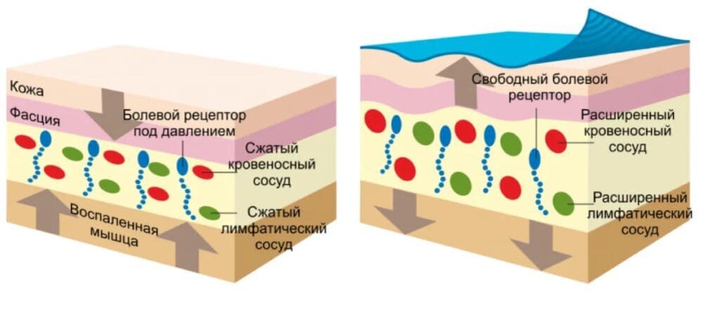 Растяжение связок, мышц и сухожилий | Тактика ведения пациентов