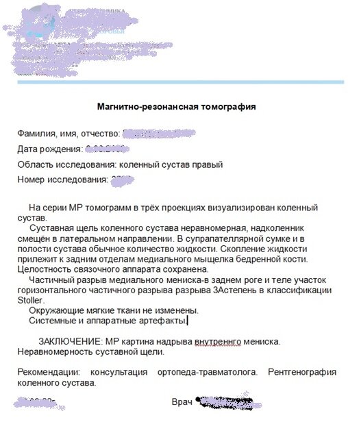 Заключение мрт: надрыв внутреннего мениска. в описании 3 а степень, что довольно серьезно.