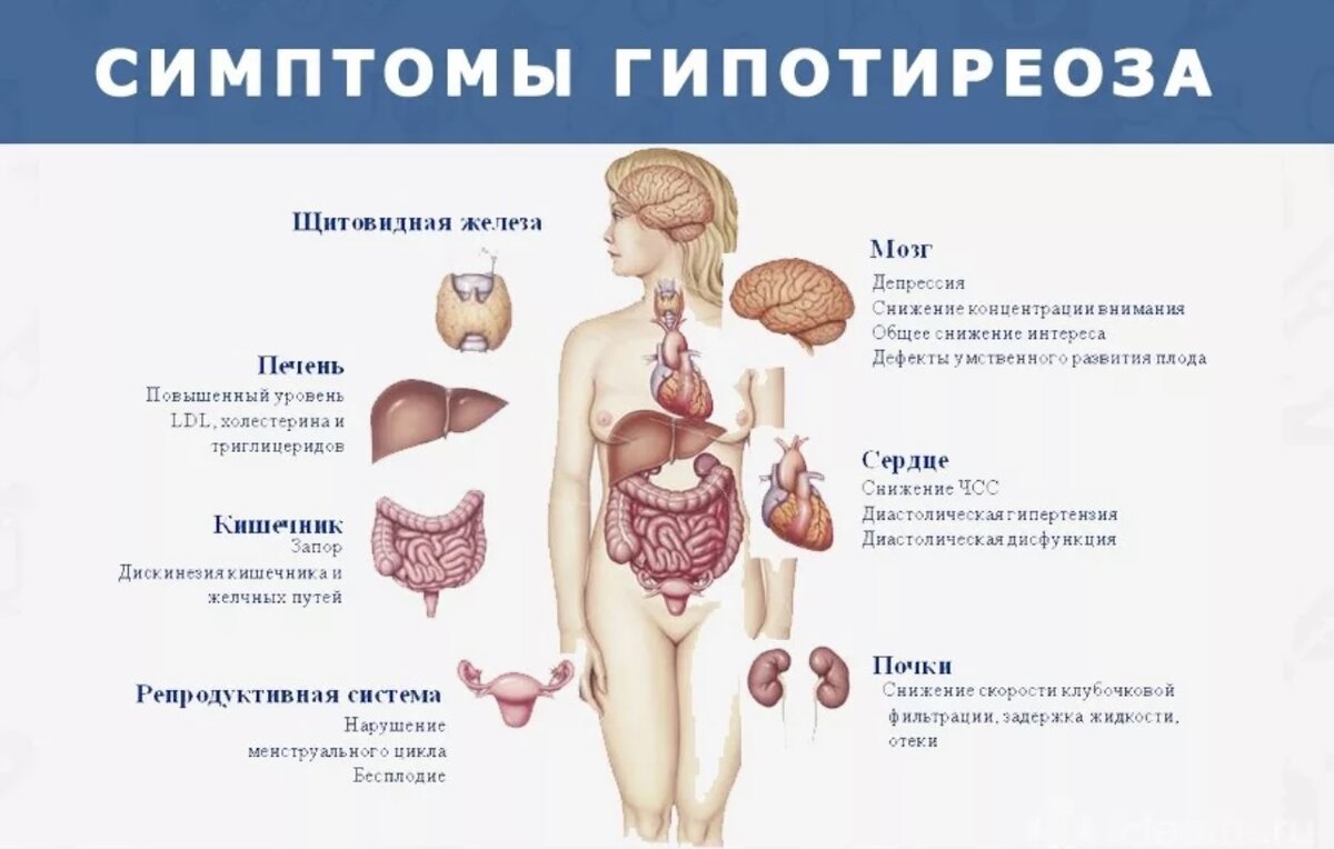 Влияние гипотиреоза на организм человека
