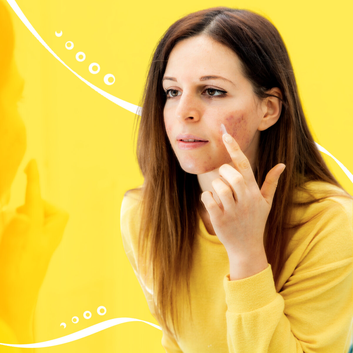 Шрам на лице: сколько времени займет лечение? | Красота без шрамов | Дзен