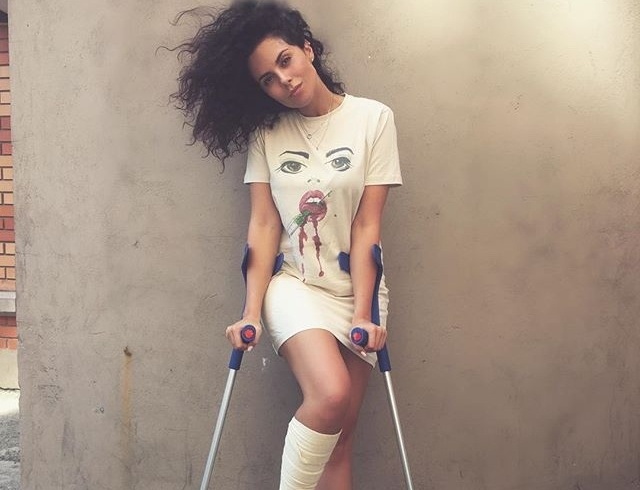 Недавно девушка травмировала ногу, но даже с перемотанной ногой она прекрасна!