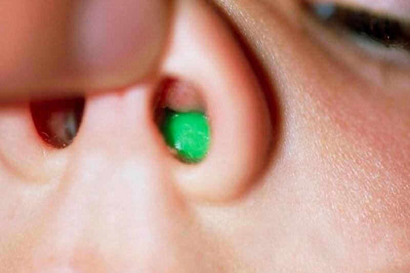 Используем при: боли в ухе, не дышит нос с затруднённым дыханием и повышенной температурой, ИНОРОДНОЕ ТЕЛО в НОСУ - сначала используем капли, затем достаём бусинку.  