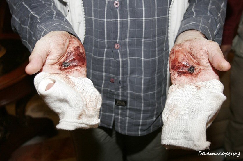 У некоторых стигматы появляются на ладонях