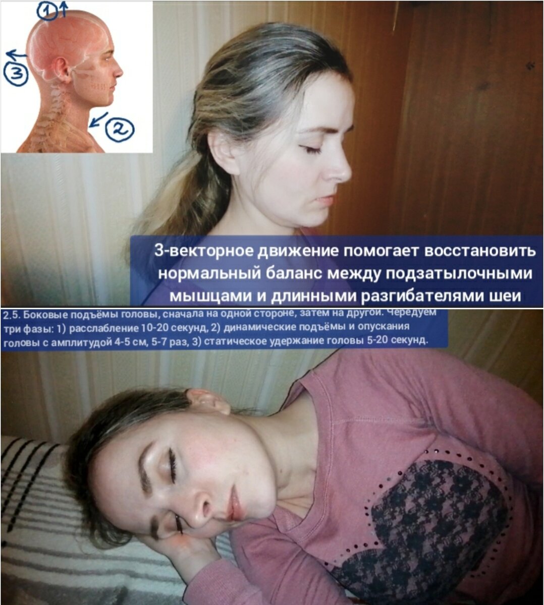 Ременная мышца шеи триггерные точки