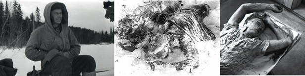 Слева - Юрий Дорошенко в походе. В центре - найденные первыми тела Кривонищенко и Дорошенко. Товарищи, пока еще живые, понимали, что для следствия положение тел должно оставаться таким как было, но, тем не менее, бережно уложили их рядом, отдав таким образом им последнюю дань памяти. Справа - Юрий Дорошенко на секционном столе. На лице видны следы пены вследствие отека легких, хотя травмы те же что и у остальных «дятловцев» - губа, спинка и кончик носа в крови, верхняя губа отечна, в районе правого и левого уха осаднения, ссадины на всем протяжении правого плеча и предплечья. 