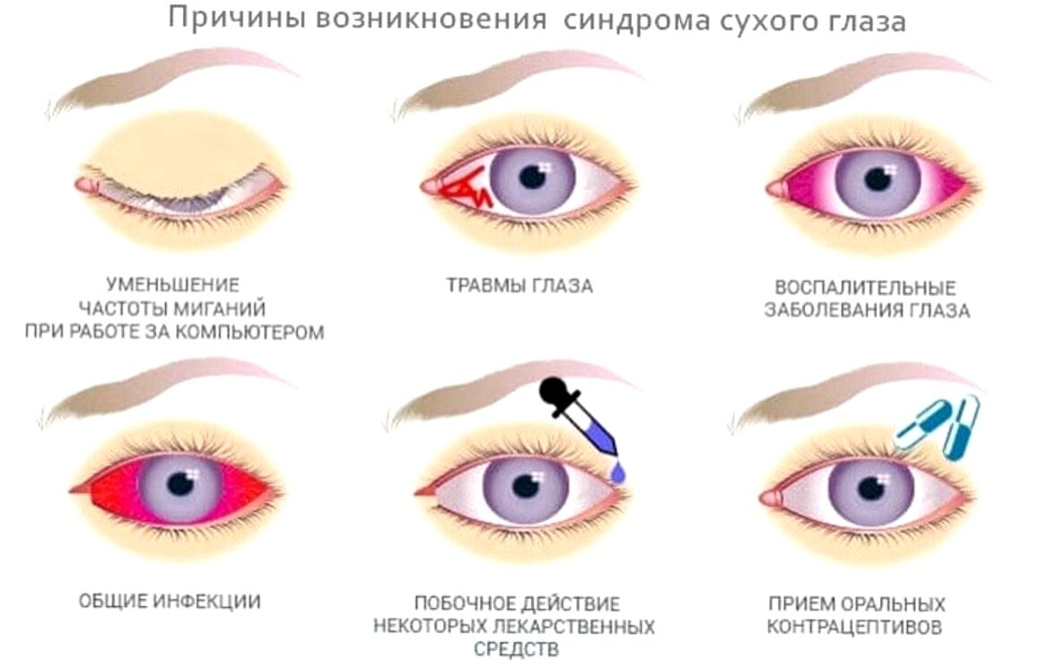 Почему в линзах расплывается изображение