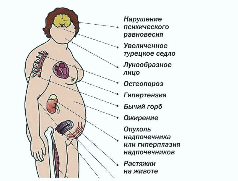 Надпочечники болезни симптомы лечение