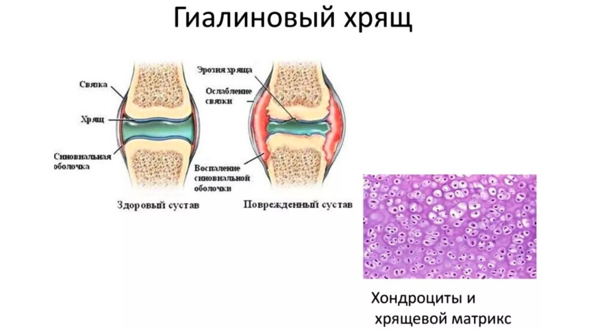 Хрящевые суставы. Строение сустава гиалиновый хрящ. Гиалиновый хрящ бедренной кости. Гиалиновый хрящ строение кости. Гиалиновый хрящ структурные компоненты.