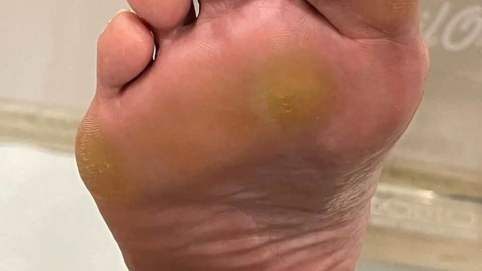 Клинический случай