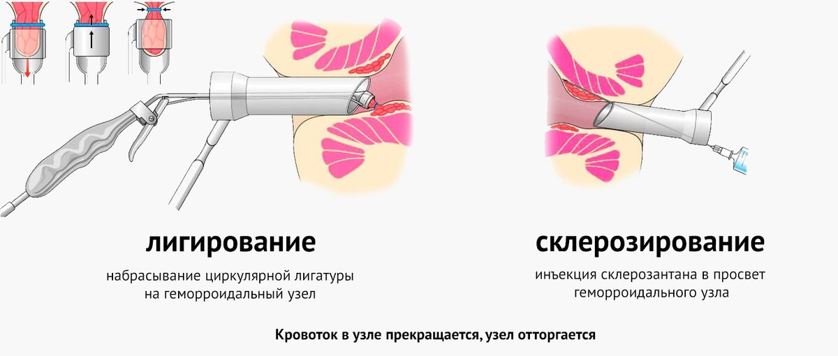 Создать карусельДобавьте описание