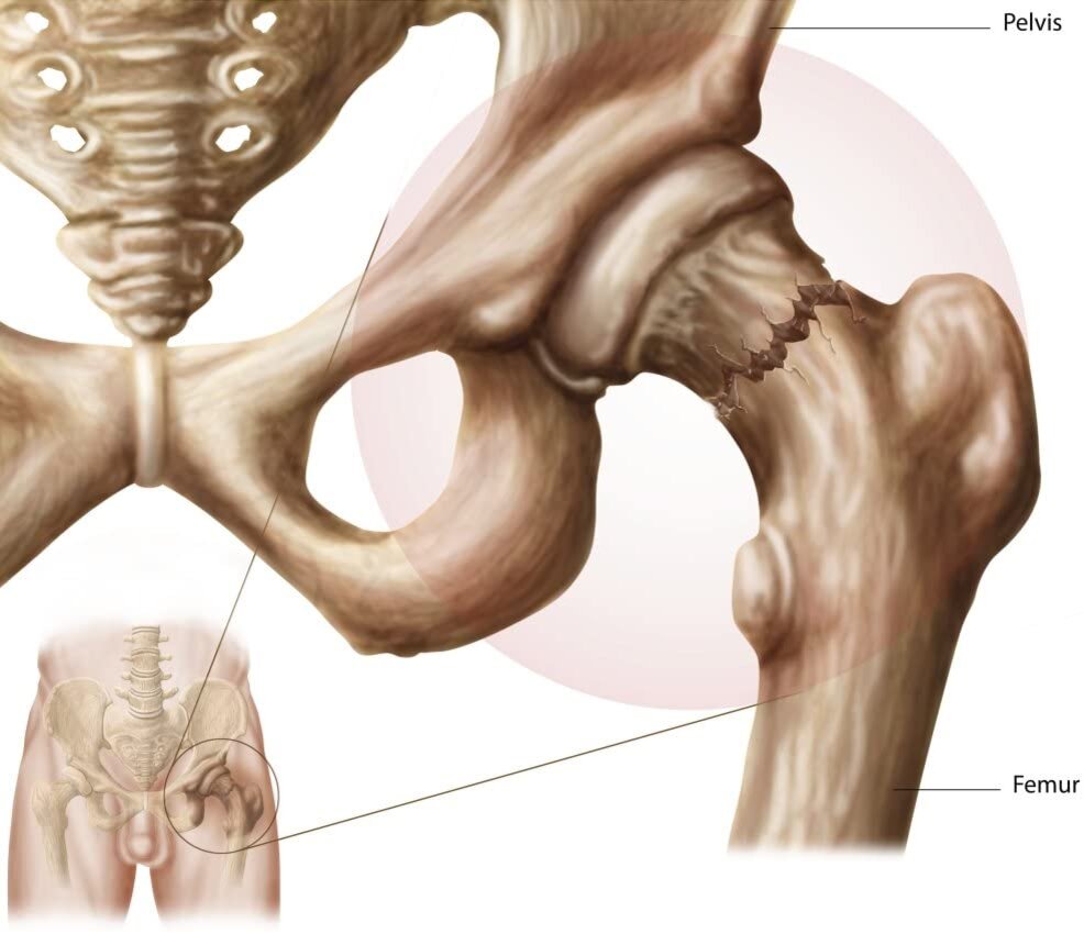 Pelvis Hip bone Sacrum Human body, pelvis, angle, furniture png PNGEgg
