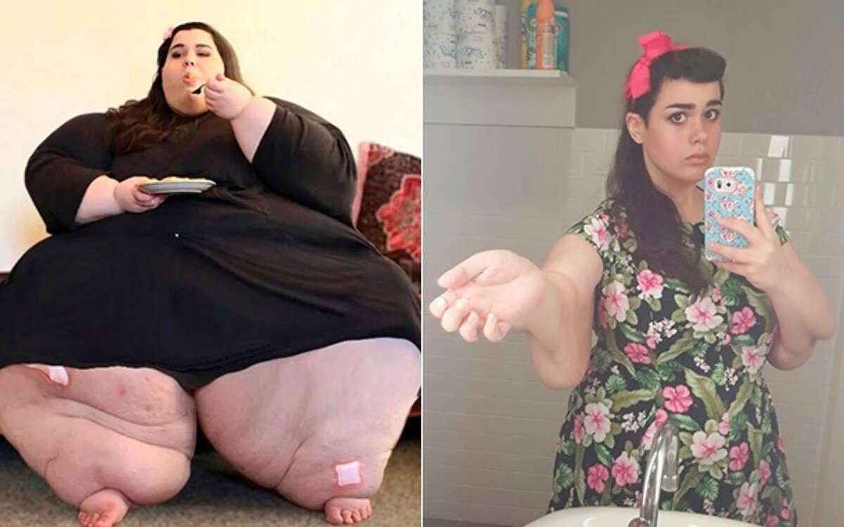 И-за своей болезни девушка могла умереть в 30 лет 😲 с сайта mirfactov.com