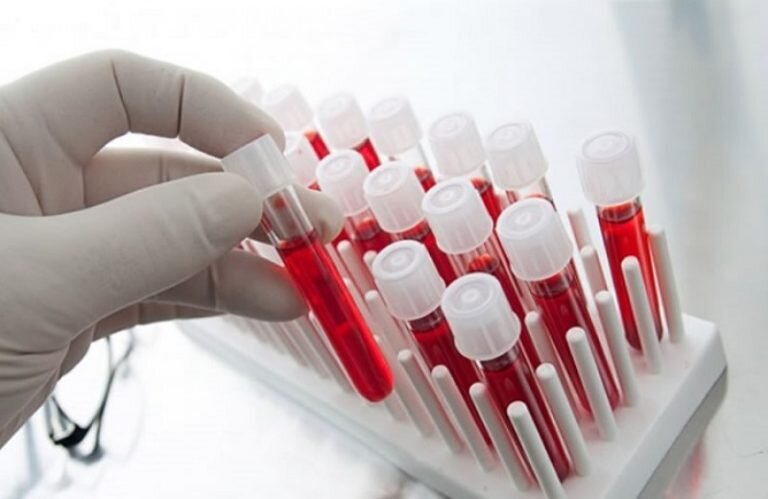    Более 5 тысяч оренбуржцев пополнили Федеральный регистр доноров костного мозга Белов Михаил Александрович