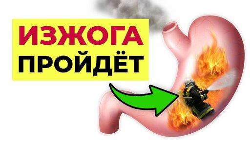 Download Video: Как избавиться от изжоги? 100% РАБОЧИЕ УПРАЖНЕНИЯ!