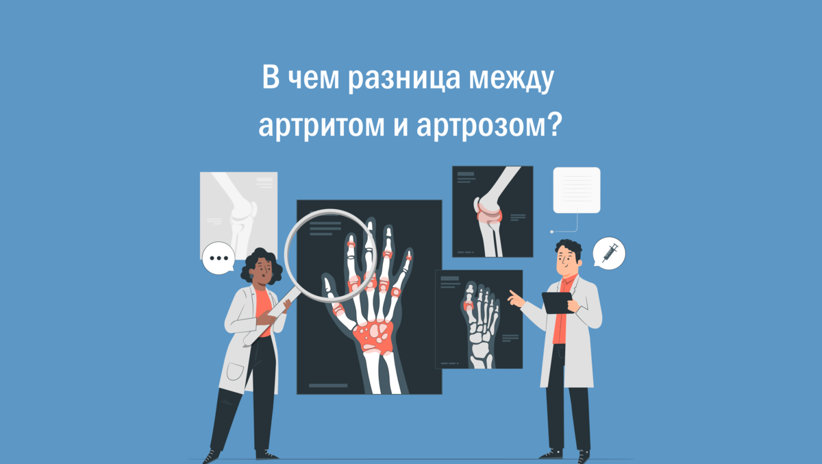 В чем разница между артритом и артрозом? | Скандинавский Центр Здоровья ...