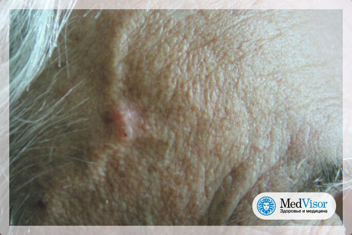  Designed by Wikimedia Commons